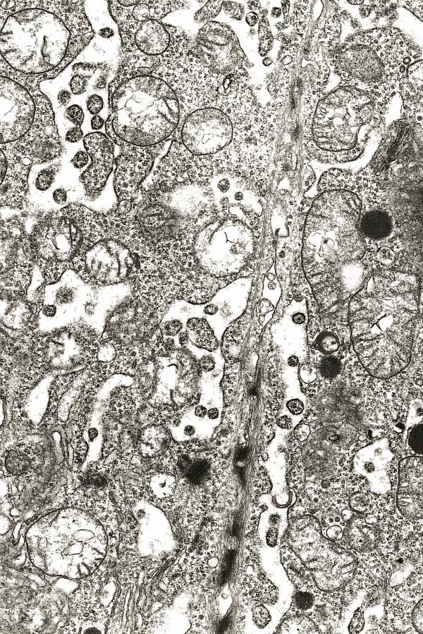 電顕写真_autophagy_1